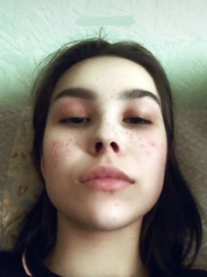 Фото врача Матвеева Татьяна Сергеевна
